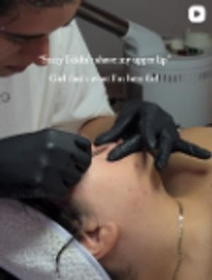 Precision dermaplaning and clean lip extractions
